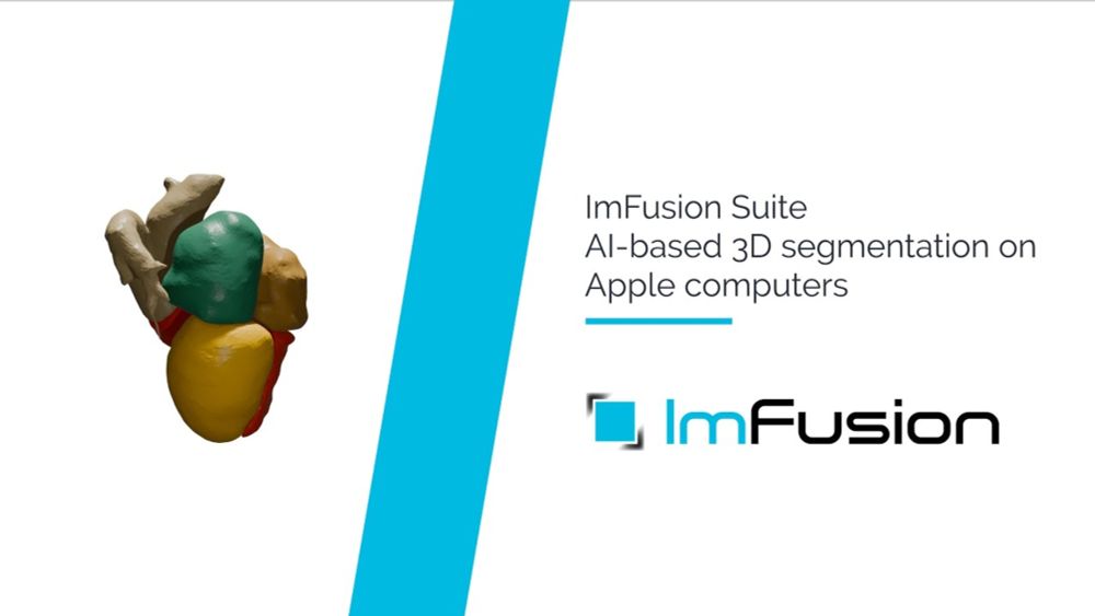 ImFusion Suite Deep Learning Module: Run PyTorch models on macOS with GPU acceleration