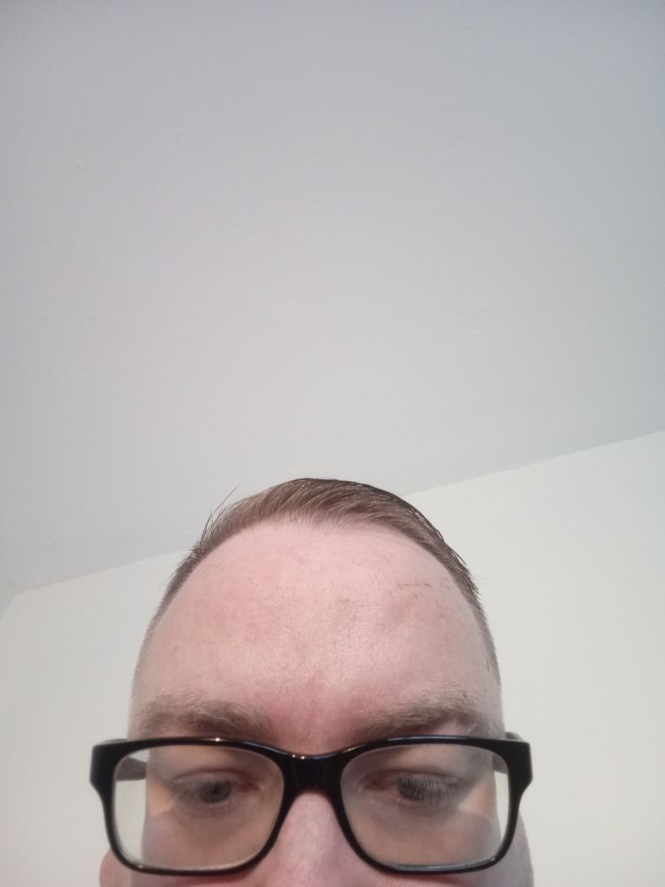 Selfie only showing my big Irish forehead