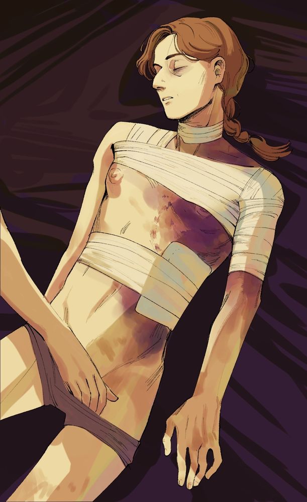 A sleeping heavily bruised person getting fondled