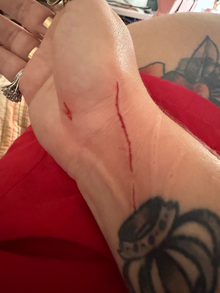 pulso de uma pessoa muito branca e tatuada, com 4 arranhões, estando dois desses sangrando