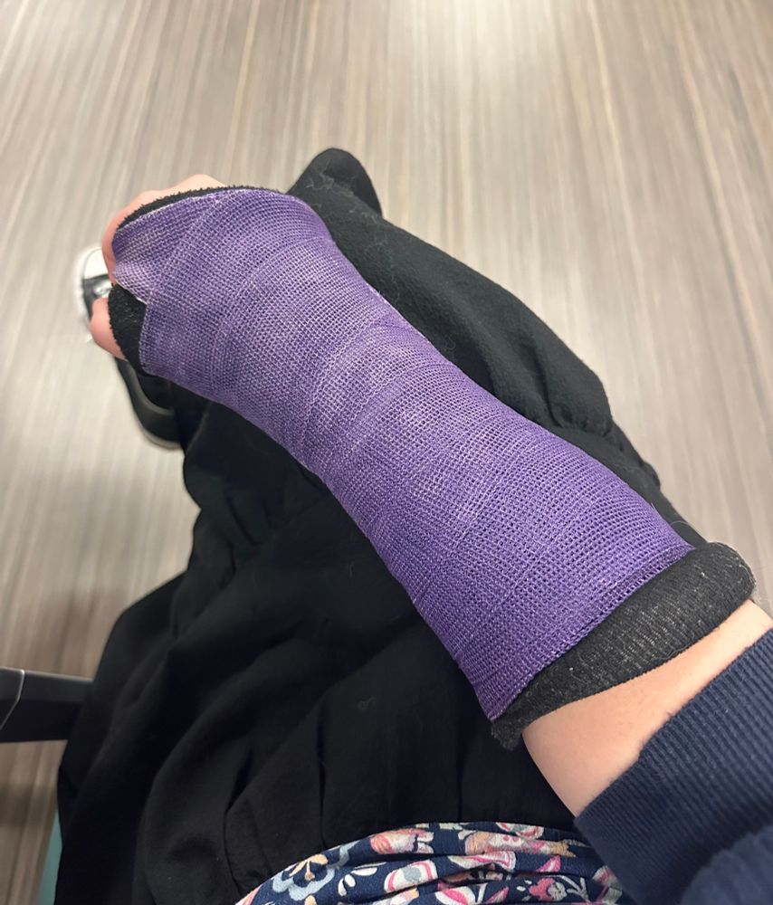 A photo from my point of view of my right forearm in a purple cast