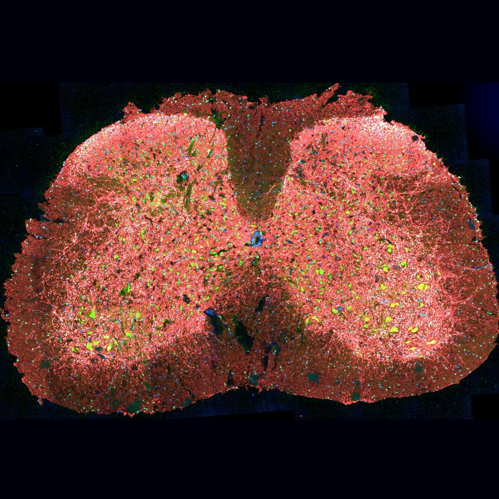 Fluorescently stained spinal cord slice