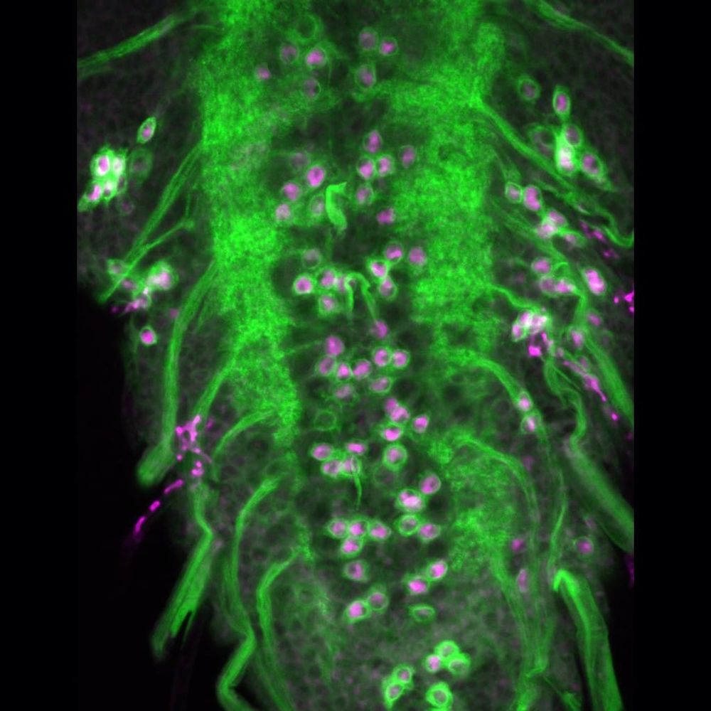 Drosophila larval motor neurons labelled with GFP (green) showing activated ATF4 expression (magenta) due to knockdown of the mitochondrial complex I subunit NDUFS1
Two larger ridges of green vertically show green processes coming out from the centre with magenta cells along the central valley between the green in clusters as well as some along the green outer processes