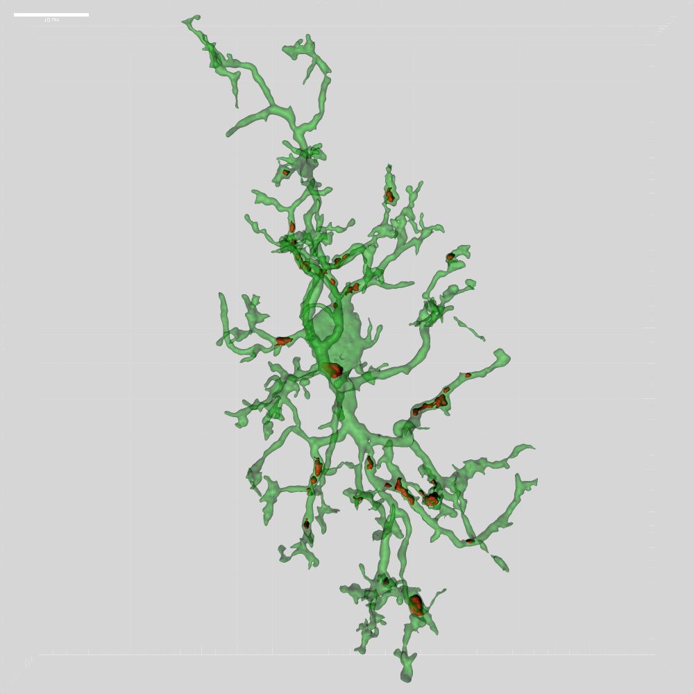 3D rending of microscope imaging data collected with a confocal showing ramifications of microglia 