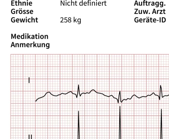Ausschnitt aus einem EKG-Datenblatt. Beim Gewicht steht "258 kg".