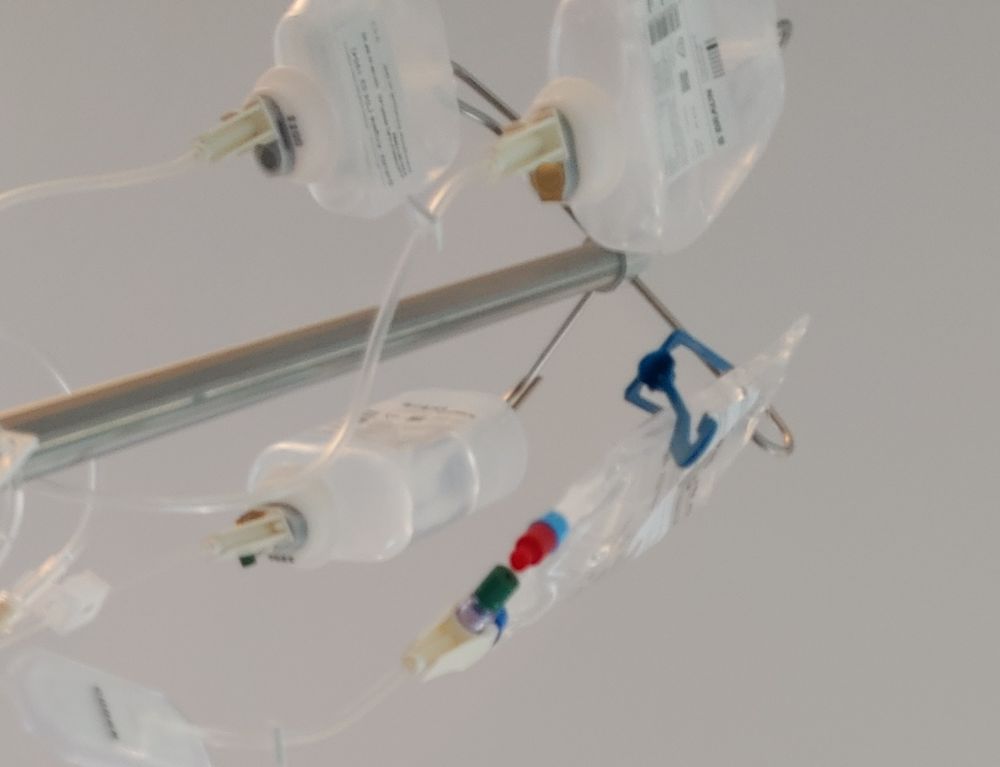 Infusionsständer mit vier verschiedenen Infusionsbehältern, darunter das Chemotherapeutikum Paclitaxel, das ich 12 mal erhalten habe