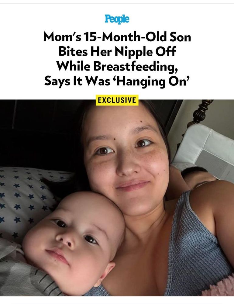 Photo of mom with baby and headline: mom's 15 month old son bites her nipple off whole breastfeeding, says it was 'hanging on'