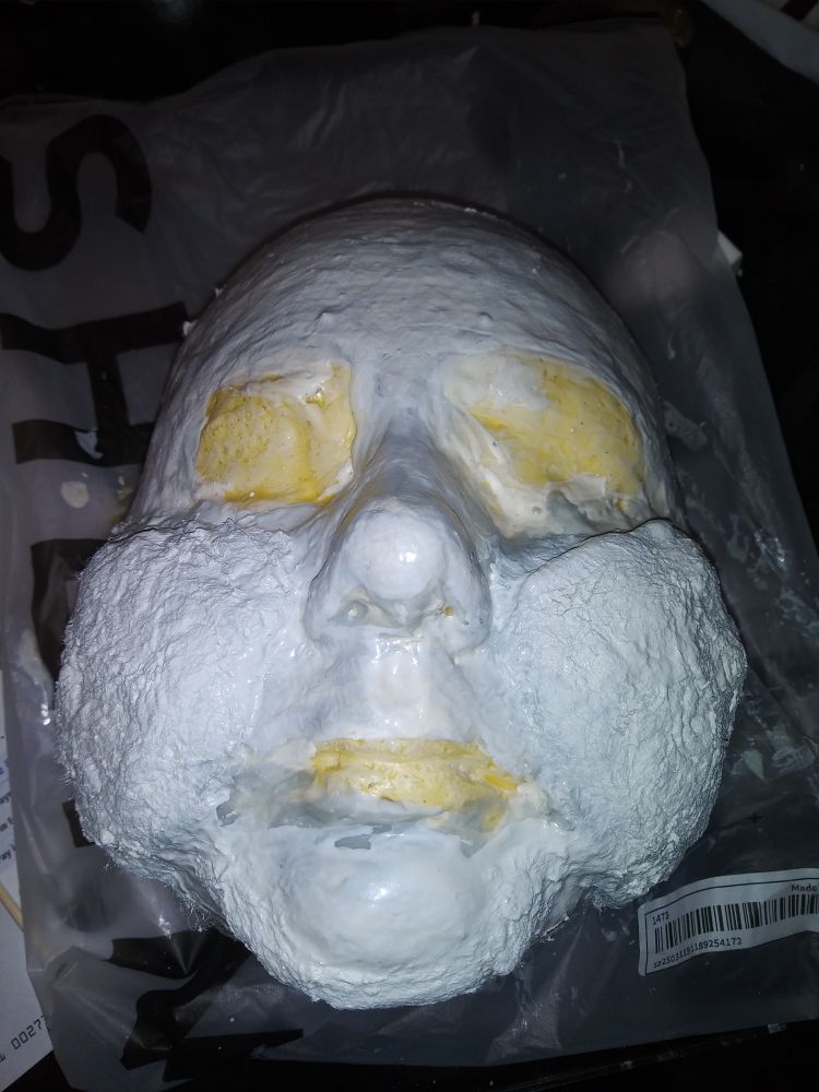 A prosthetic in progress made of liquid latex and cotton on top of a plaster face casting. 