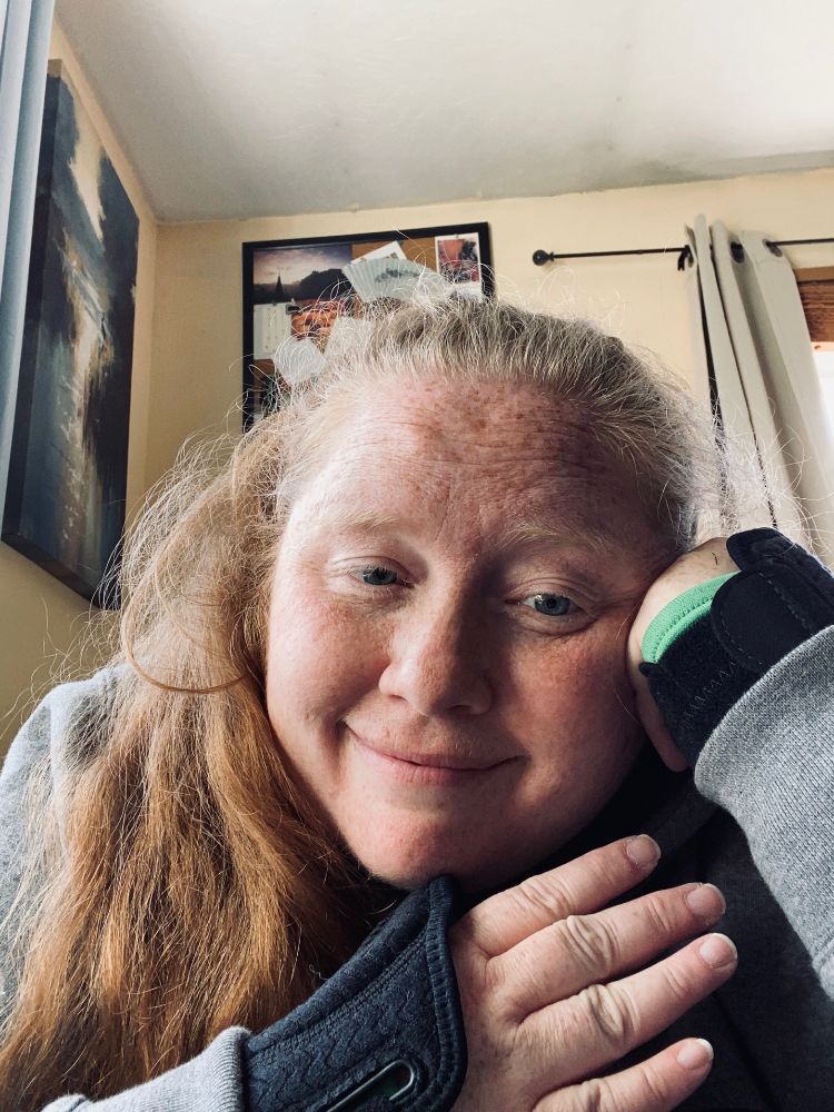 Selfie of Cassandra (rumpled redhead in a grey hoodie) with hands held up in wrist braces)