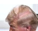 crop of a photo highlighting a huge bald patch on the top of his head. 