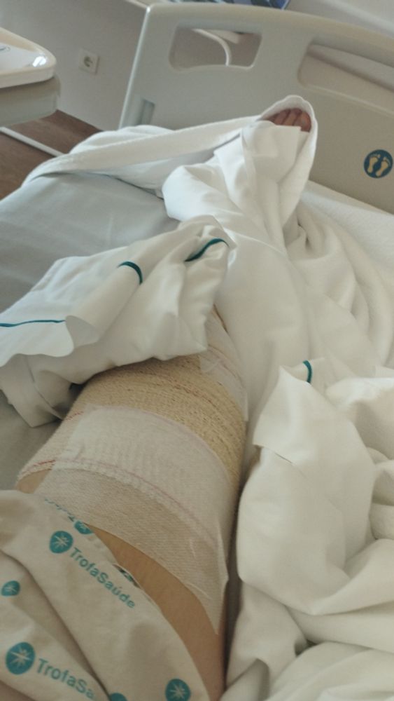 Photo of a leg in bandages on a medical bed