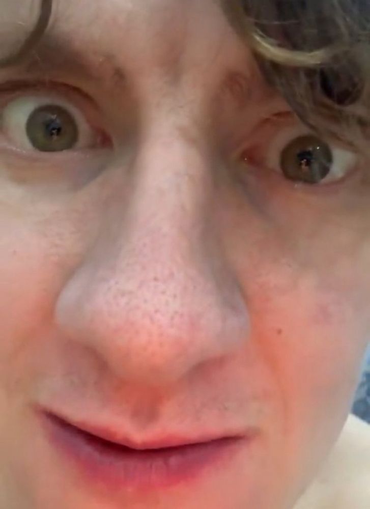 erik ahrens nase im groß aufnahme 