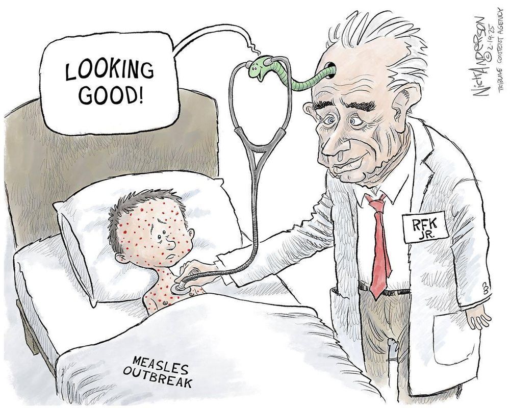 The brain worm in RFK's head diagnosis a child with Measles as "Looking Good!"