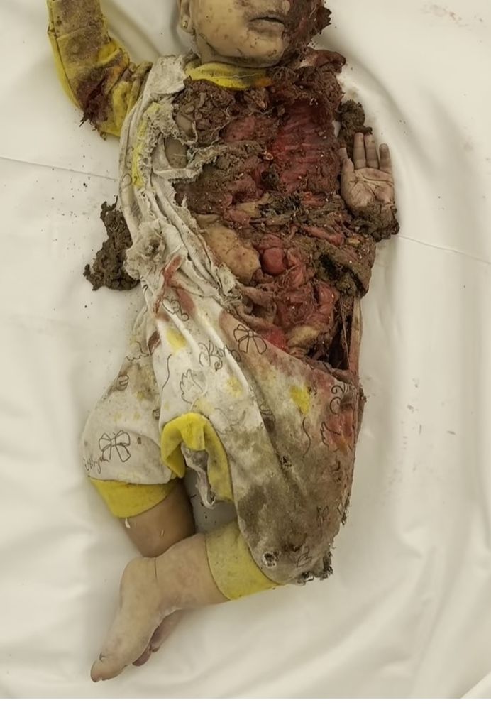 The deceased body of Palastinian infant whose internal organs are exposed due to Israeli American bombs.