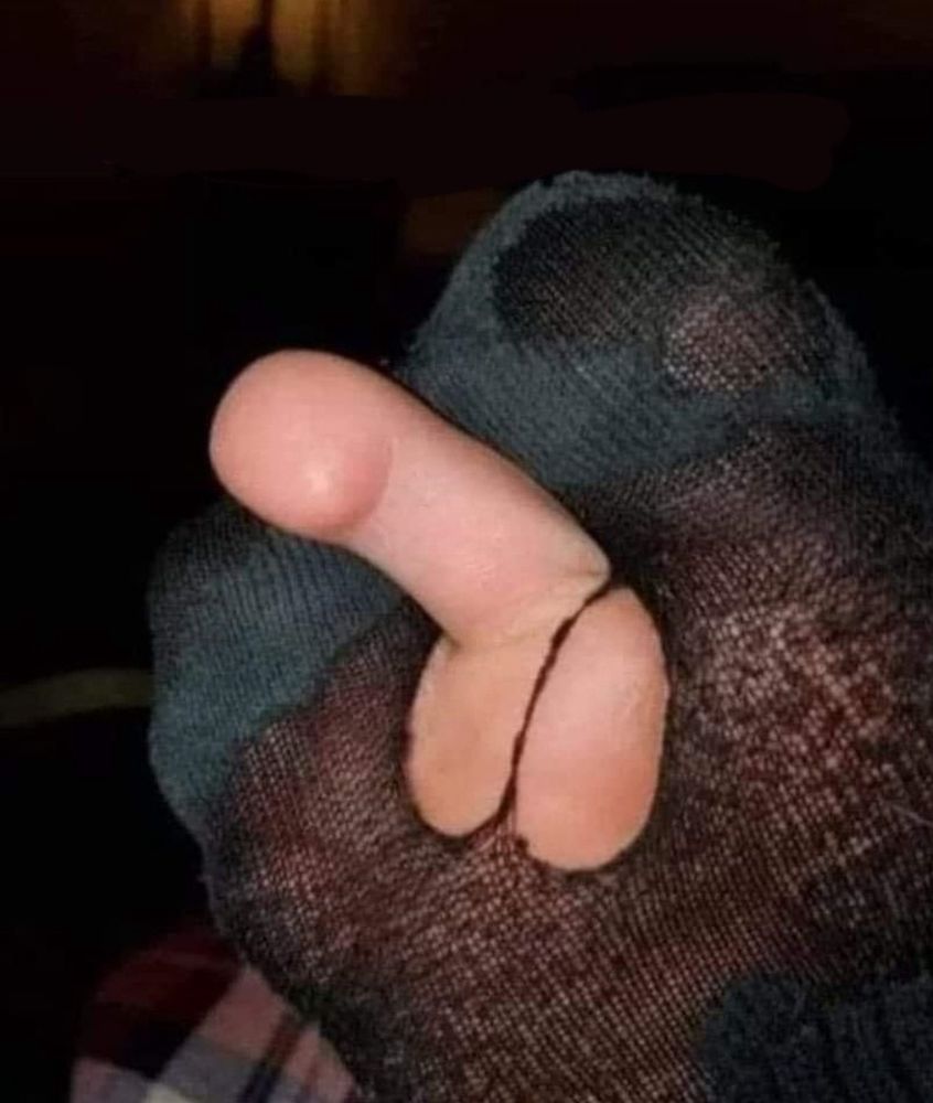 Toe sticking out of a hole in a black sock.
