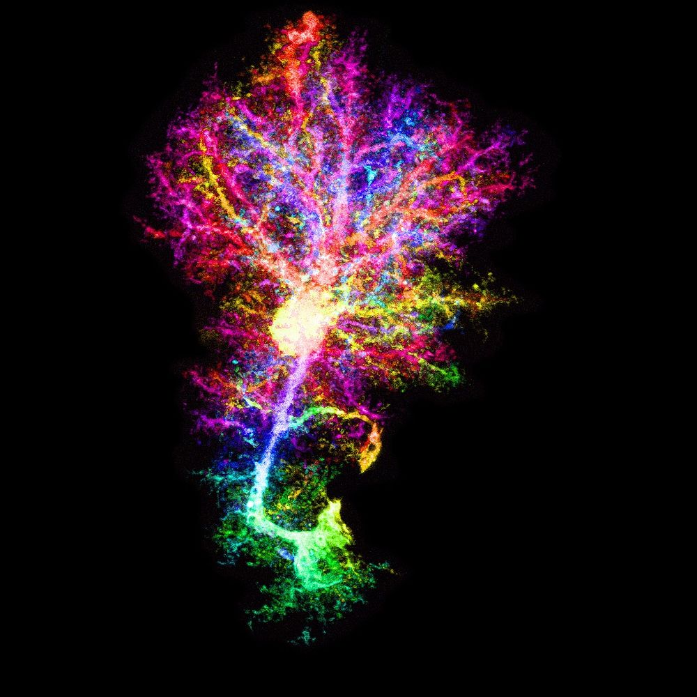 A fuzzy, complex cell with radiating branches in pink, red and yellow, with one green branch extending down and right to where it would wrap around a blood vessel