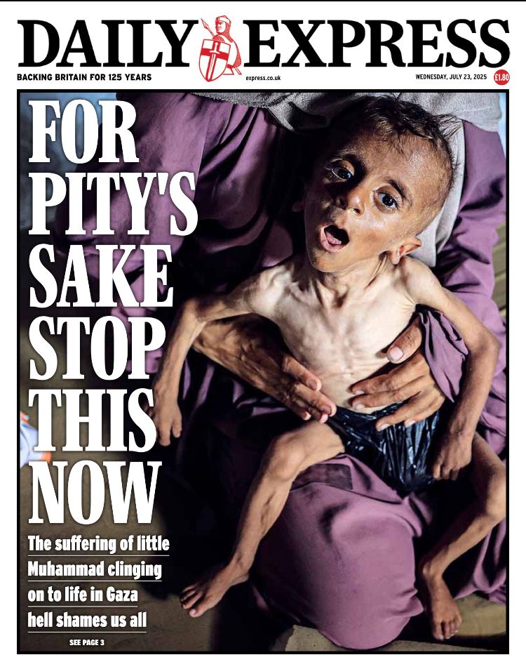 Express Newspaper front page with image of starving child 
FOR PITY'S SAKE STOP THIS
The suffering of little Muhammad clinging on to life in Gaza hell shames us all
