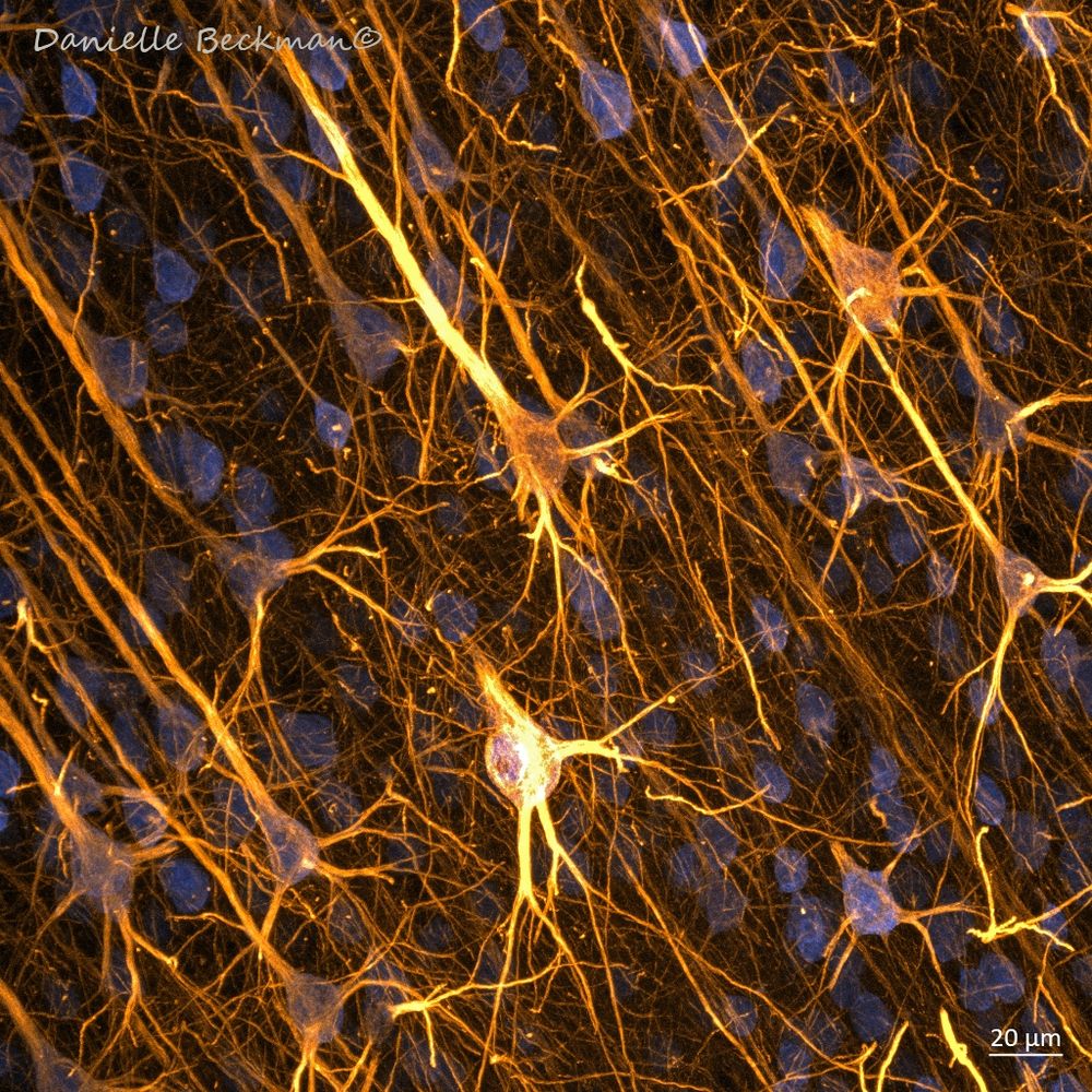 Neurons in the human cortex. 
