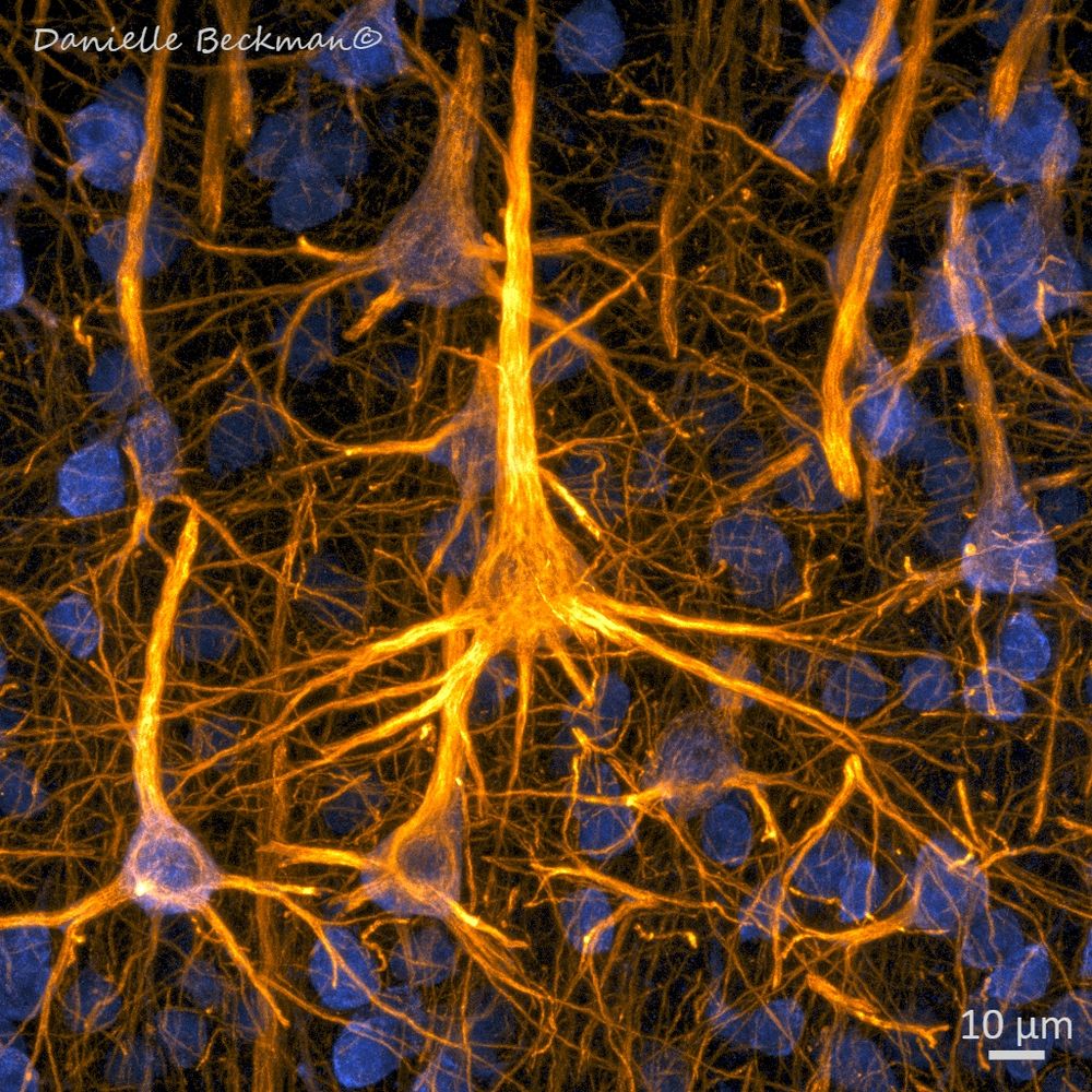 Neurons in the human cortex. 