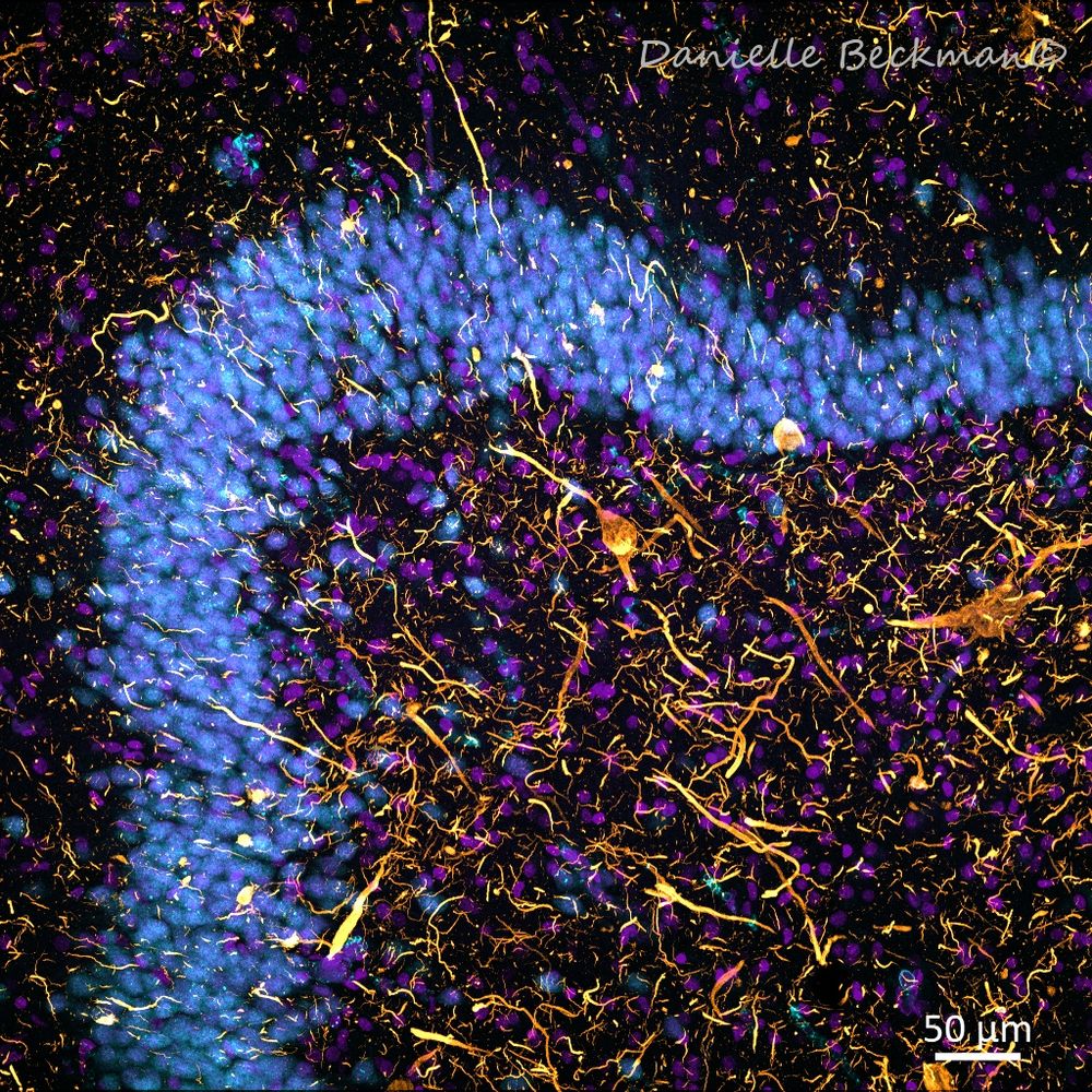 Fluorescence confocal microscopy photo of the brain
