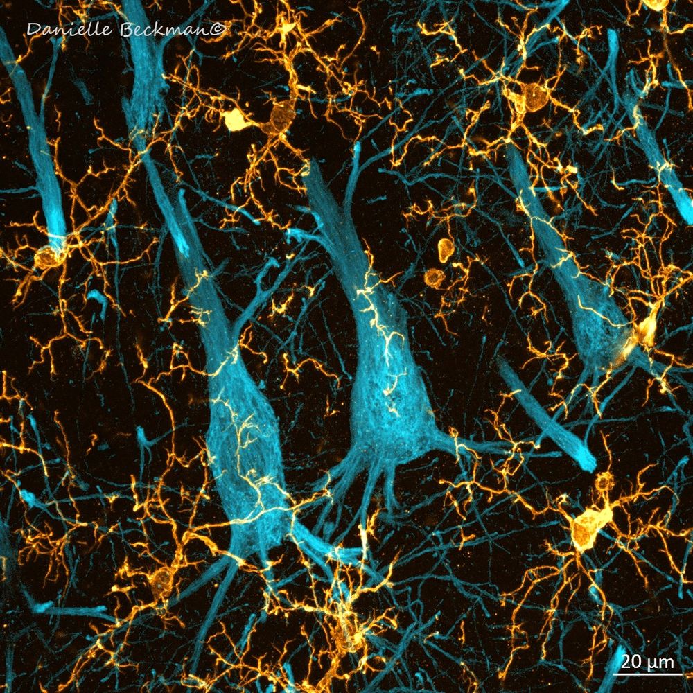 Confocal microscopy image showing neurons and microglia
