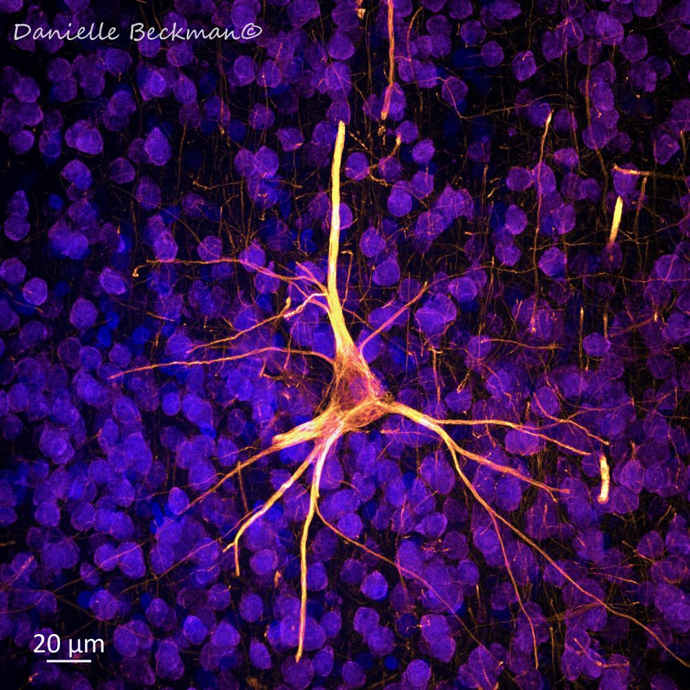A single neuron in the human neocortex - photo taken with a confocal microscope
