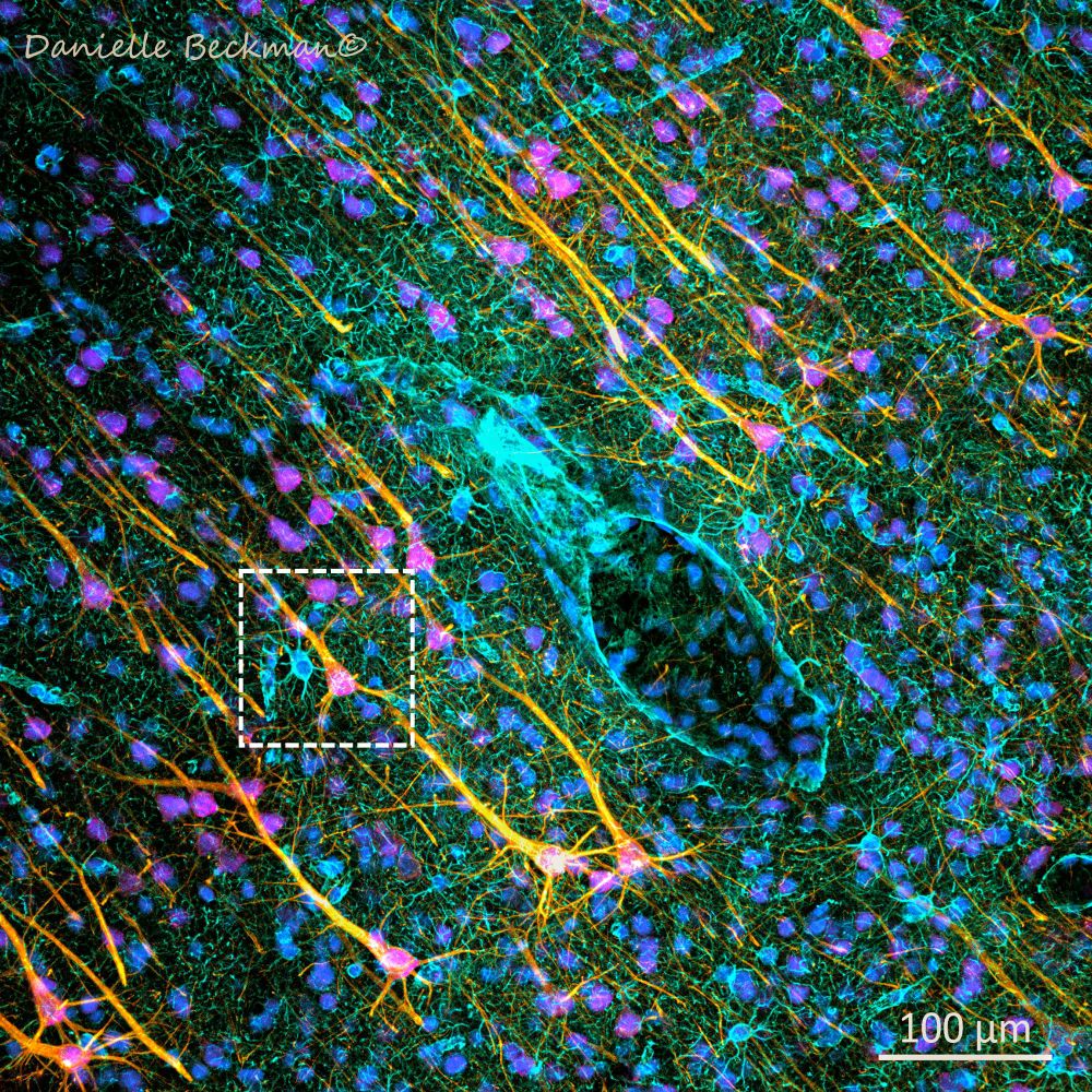 Confocal microscopy photo of the cortex showing neurons and astrocytes