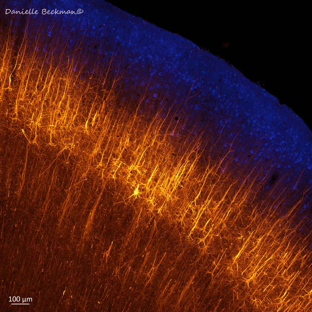 Confocal microscopy photo of the brain showing pyramidal neurons in the frontal cortex