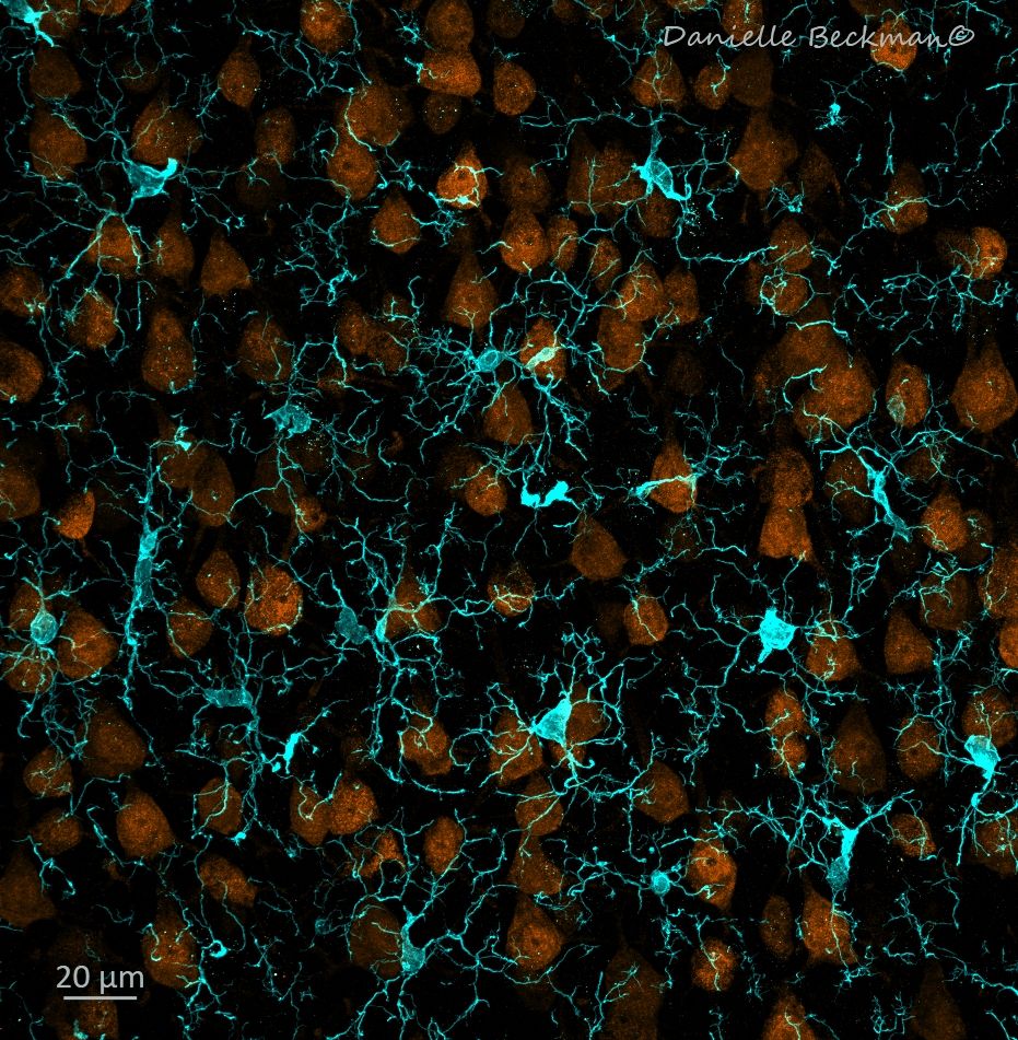 Confocal microscopy photo - control olfactory cortex