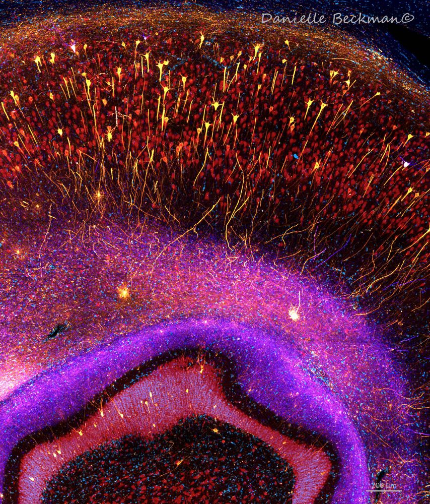 Confocal micrograph