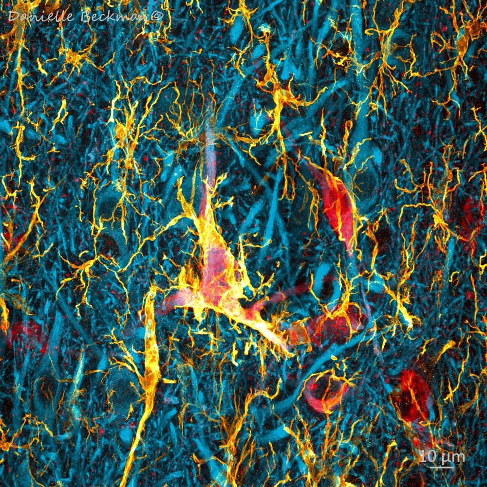 Confocal microscopy image showing microglia interacting with neurons accumulating pathological tau protein in Alzheimer's disease