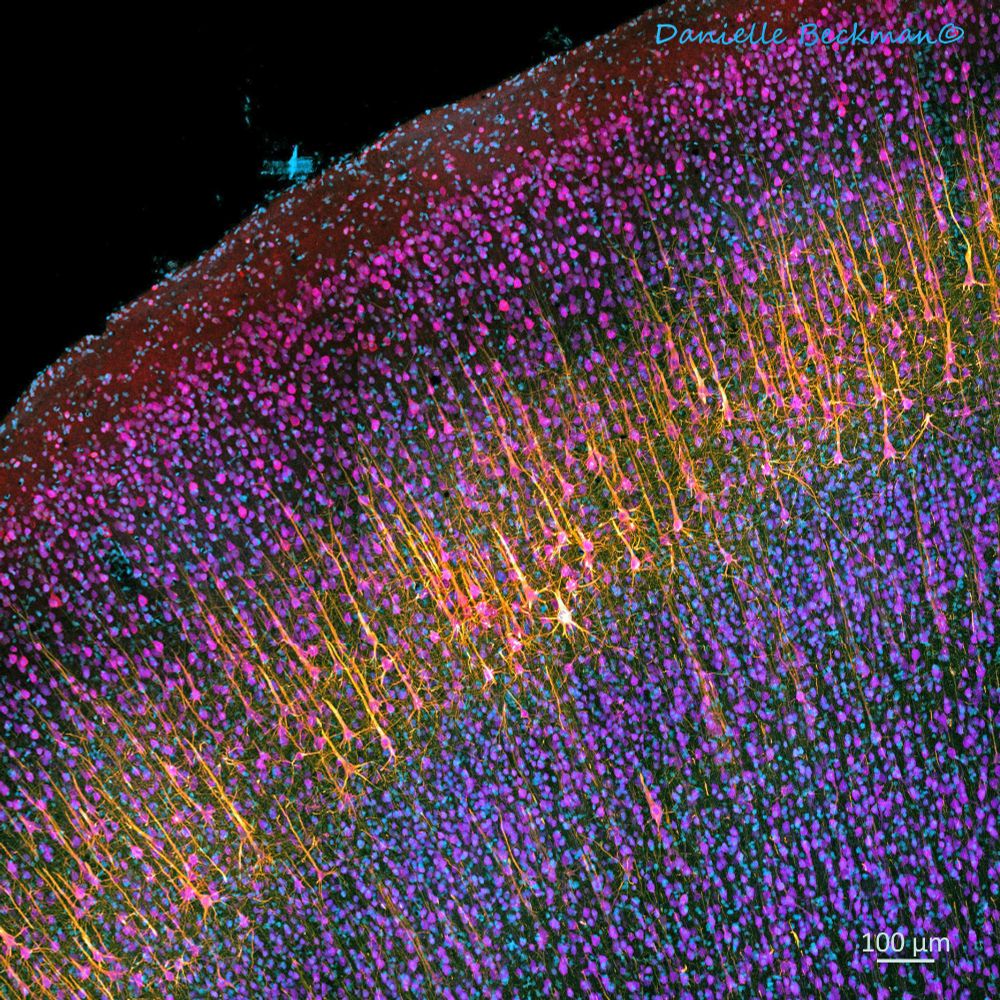 Microscopy image of a piece of the cortex of rhesus macaque. Markers shown are dapi (blue), pyramidal neurons in yellow (smi32),  calreticulin (pink), and neun (purple). 