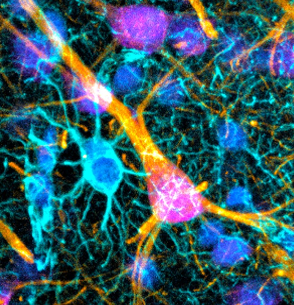 Confocal microscopy photo of the cortex showing neurons and astrocytes