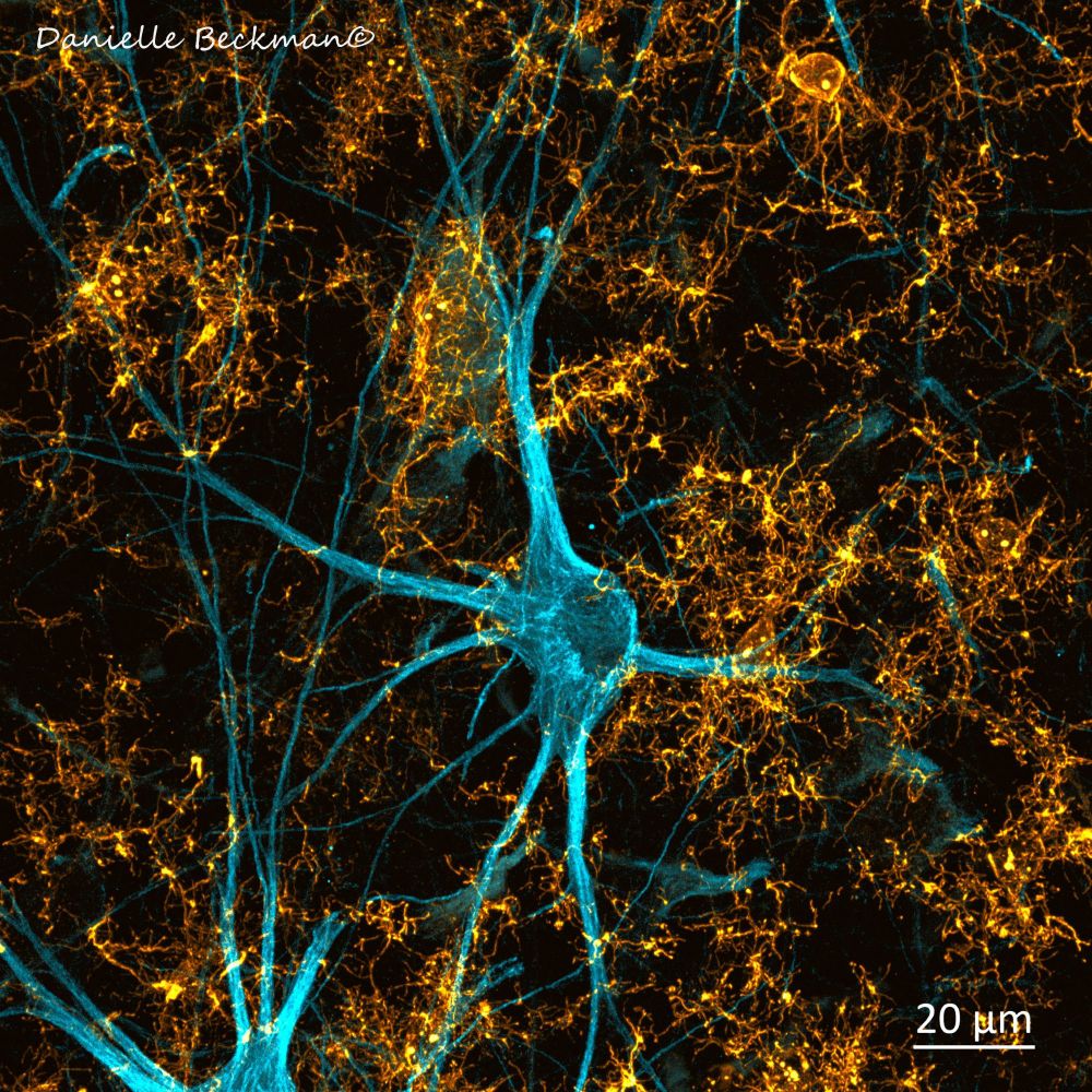 Big blue neurons surrounded by small yellow microglia everywhere!