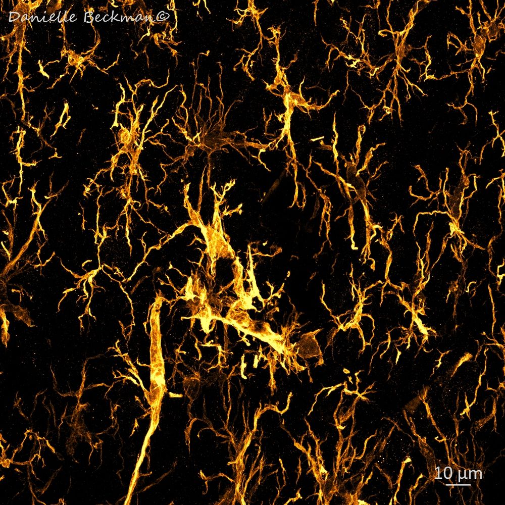 Confocal microscopy image showing microglia interacting with neurons accumulating pathological tau protein in Alzheimer's disease (microglia IBA-1 channel only)