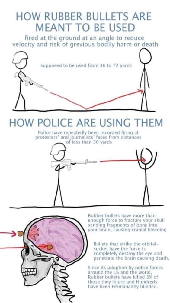 How rubber bullets are meant to be used
fired at the ground at an angle to reduce velocity and risk of grevious bodily harm or death
supposed to be used from 36 to 72 yards

How police are using them
Police have repeatedly been recorded firing at protestors and journalists' faces from distances of less than 30 yards

Rubber bullets have more than enough force to fracture your skull sending fragments of bone into your brain, causing cranial bleeding

Bullets that strike the orbital-socket have the force to completely destroy the eye and penetrate the brain causing death.

Since its adoption by police forces around the US and the world, rubber bullets have killed 3% of those they injure and hundreds have been permanently blinded.
