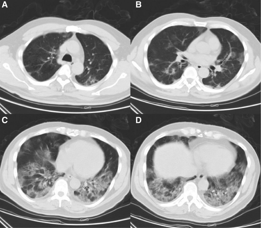 Clinical and radiological features of a case of primary... : Medicine