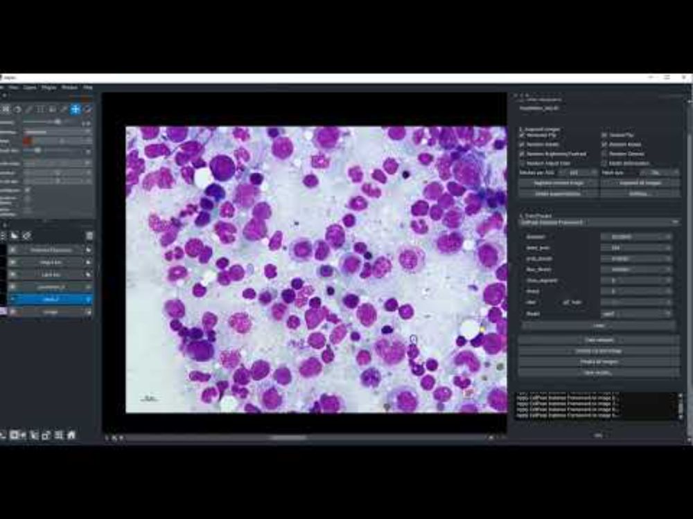 Pixi and Napari-Easy-augment-Batch-DL