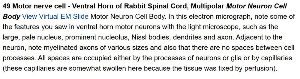Screenshot of text: 49 Motor nerve cell - Ventral Horn of Rabbit Spinal Cord, Multipolar Motor Neuron Cell Body View Virtual EM Slide Motor Neuron Cell Body. In this electron micrograph, note some of the features you saw in ventral horn motor neurons with the light microscope, such as the large, pale nucleus, prominent nucleolus, Nissl bodies, dendrites and axon. Adjacent to the neuron, note myelinated axons of various sizes and also that there are no spaces between cell processes. All spaces are occupied either by the processes of neurons or glia or by capillaries (these capillaries are somewhat swollen here because the tissue was fixed by perfusion).
