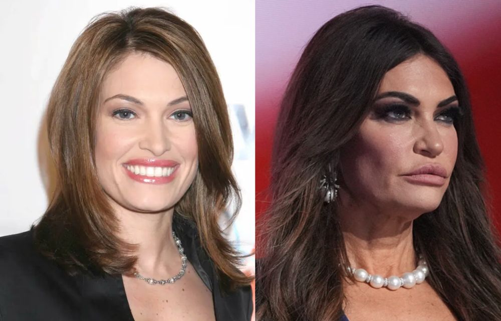 Kimberly Guilfoyle, before and after a shit ton of plastic surgery