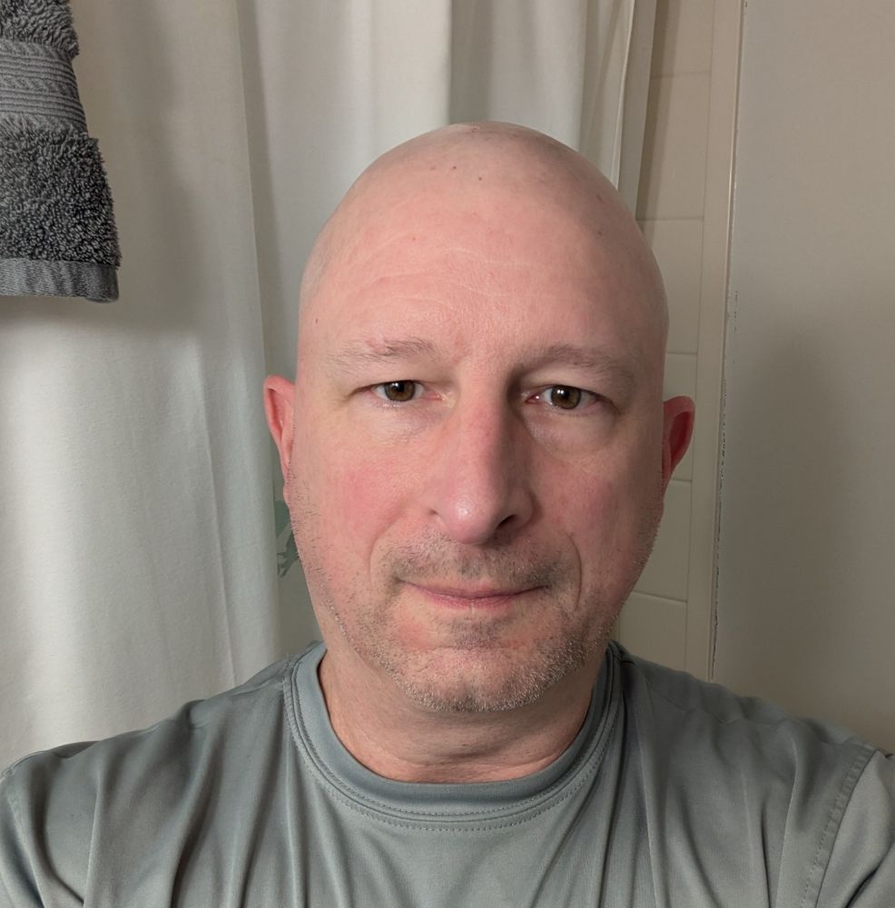 photo of me in a grey shirt scruffy face and shaved head. 