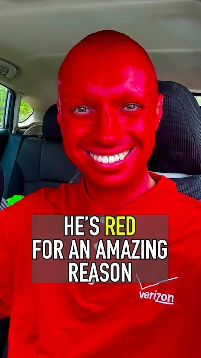 photo of an extremely red dan hentschel smiling, captioned "he's red for an amazing reason"