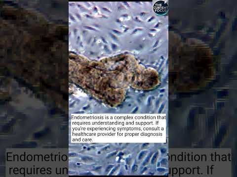 What is Endometriosis?