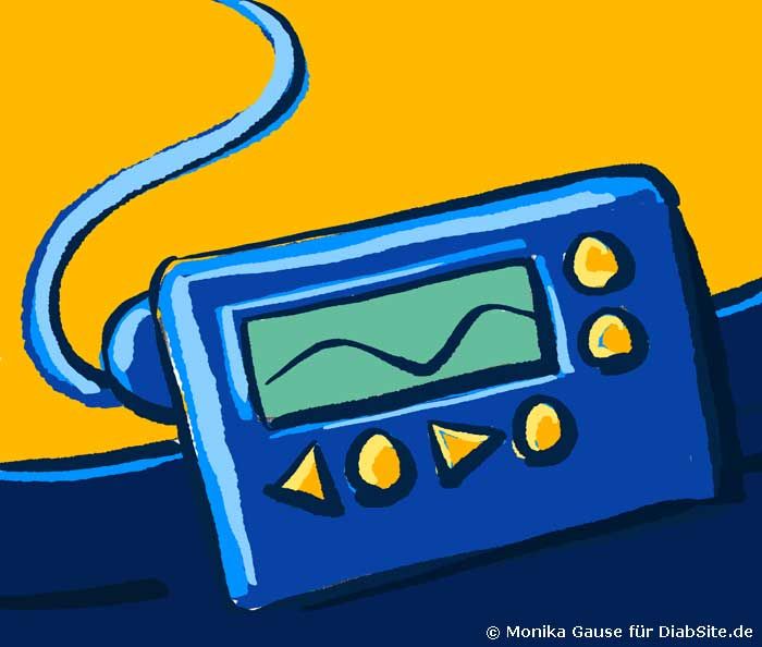 Insulinpumpe für Menschen mit Diabetes.