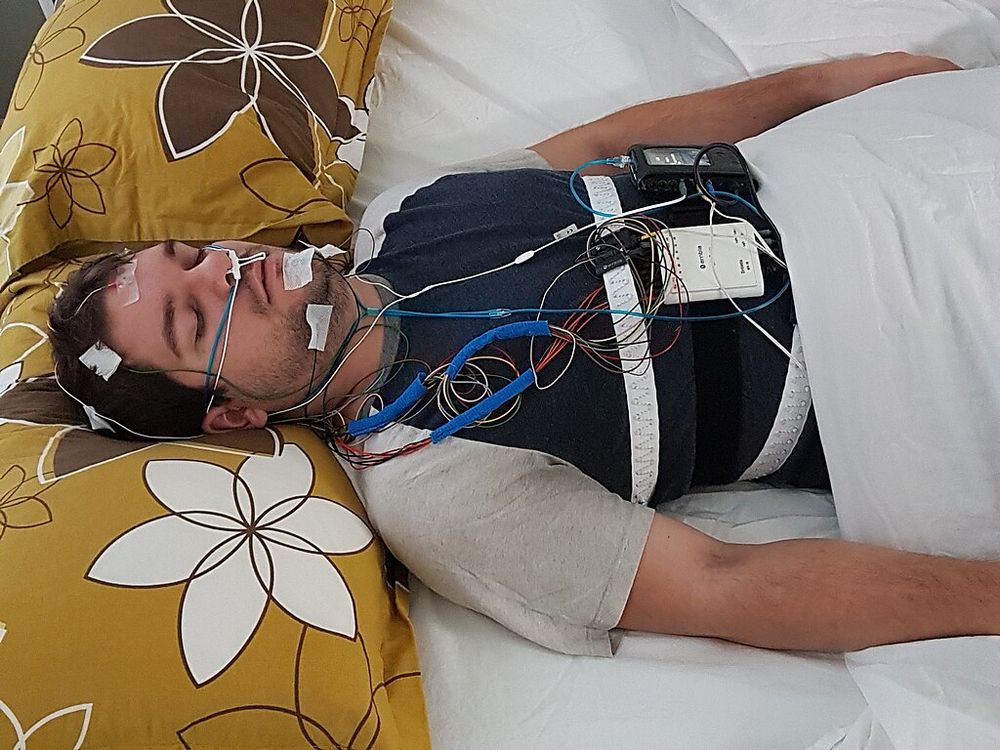 Traditional PSG study setup. Image taken from Wikimedia.