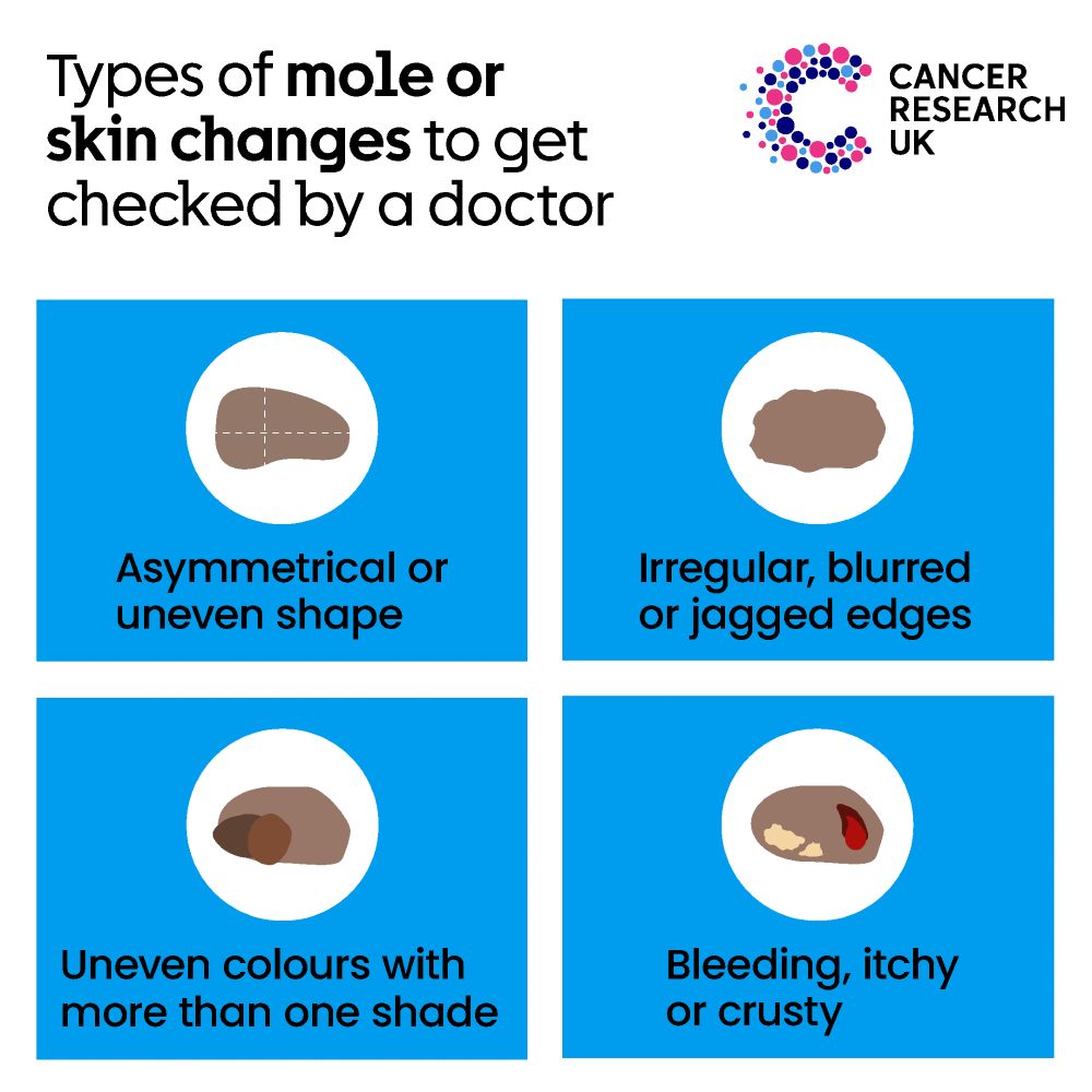 An infographic that shows four illustrations of skin changes. It's titled: 'Types of mole or skin changes to get checked out.' followed by 'Asymmetrical or uneven shape', 'Irregular, blurred or jagged edges', 'Uneven colours with more than one shade', and 'Bleeding, itchy or crusty'.