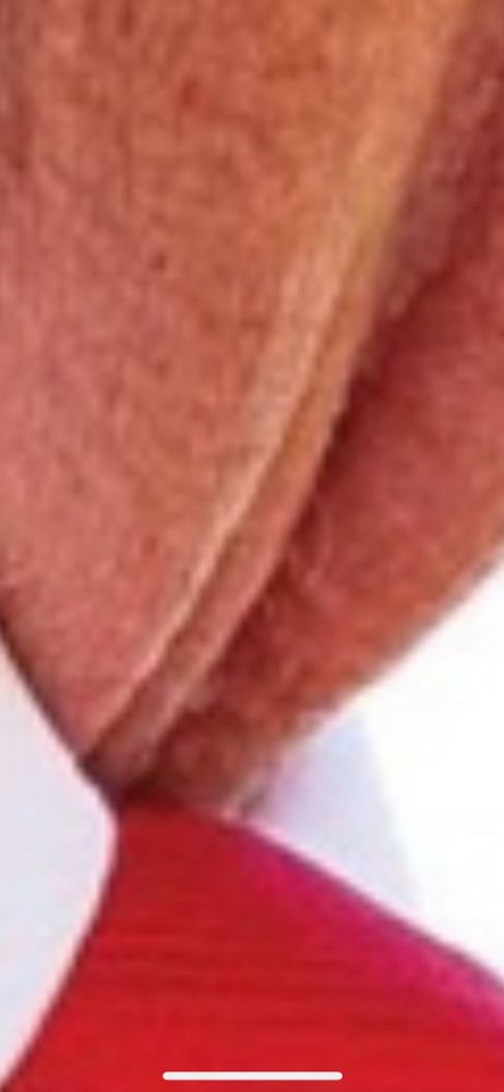 Extreme zoom-in onTrump’s neck