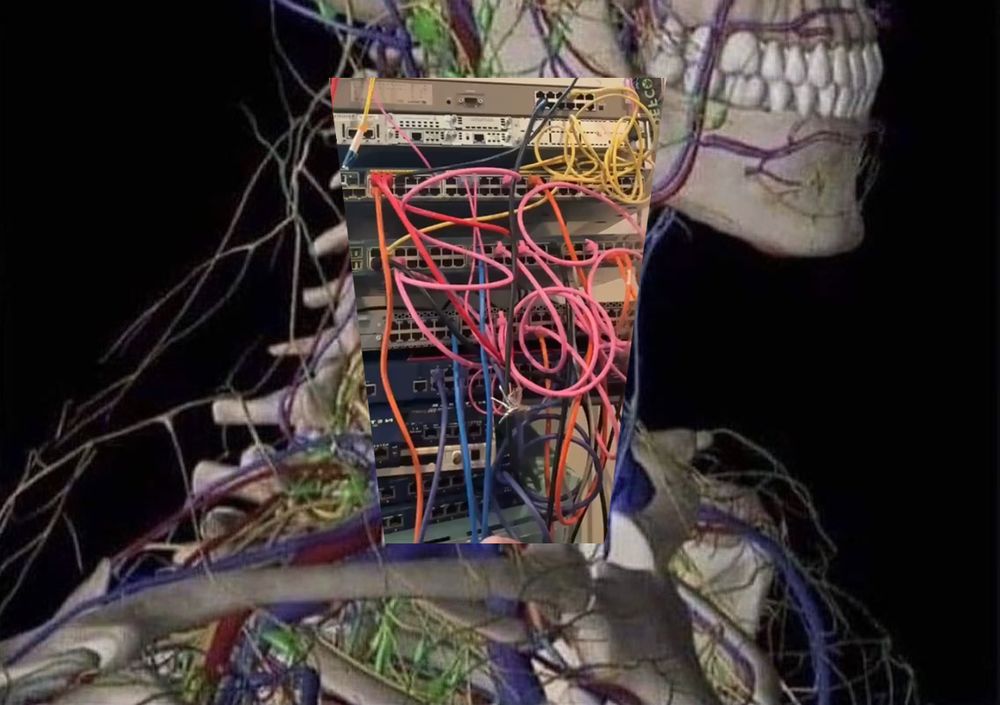 complex human veins in the neck meme, but instead overlaid with TracketPacer's messy (and completely normal) test lab cabling