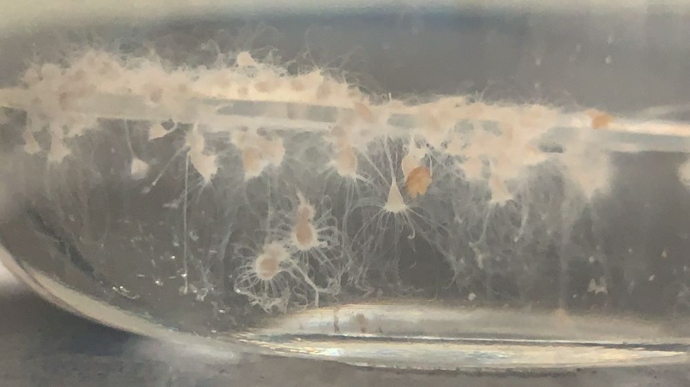 Close up of slide of jellyfish polyps, which are whiteish in color and hanging their tentacles down. In the center is an orange-red early jellyfish about to pop off of one polyp.