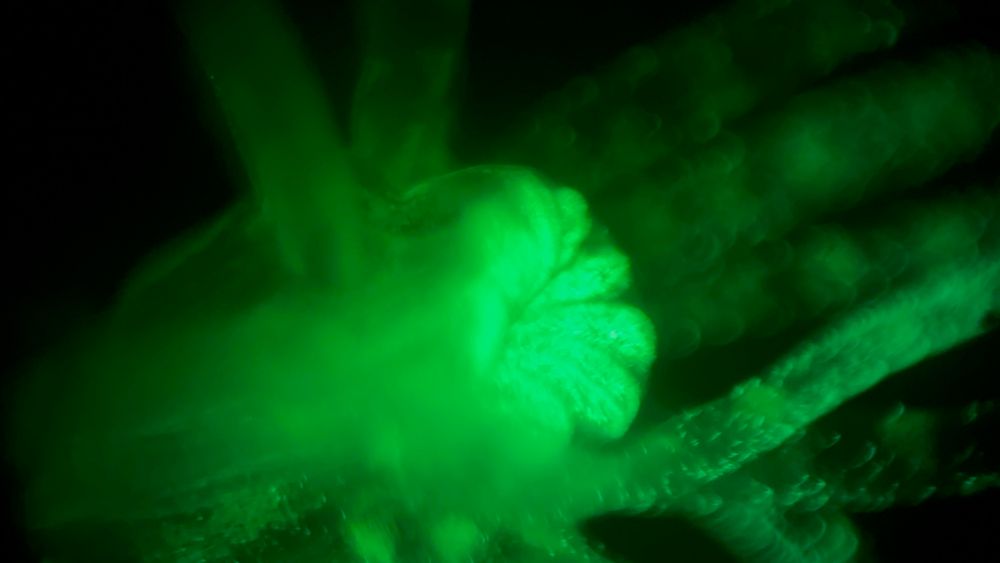 Close up image through microscope of the mouth and surrounding tentacles of an adult starlet sea anemone. The green spots all around the animal are developing or mature stinging cells. The green is most dense around the mouth. 